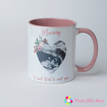 Load image into Gallery viewer, Personalised 11oz Mug Scan Cup || GIFT || Ultrasound
